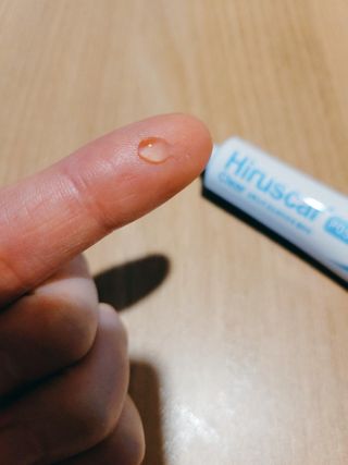 히루스카 포스트아크네 클리어 — 5점을 준 리뷰어가 2021년 2월 올린 사용 사진