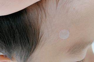 [큐어반H 스팟] 자외선 99프로 차단되는 스틱타입 스팟밴드(1팩 / 66매입) — 5점을 준 리뷰어가 2022년 10월 올린 사용 사진