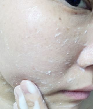 [후르디아] 아보카도 비건 약산성 효소필링젤 — 5점을 준 리뷰어가 2024년 2월 올린 사용 사진