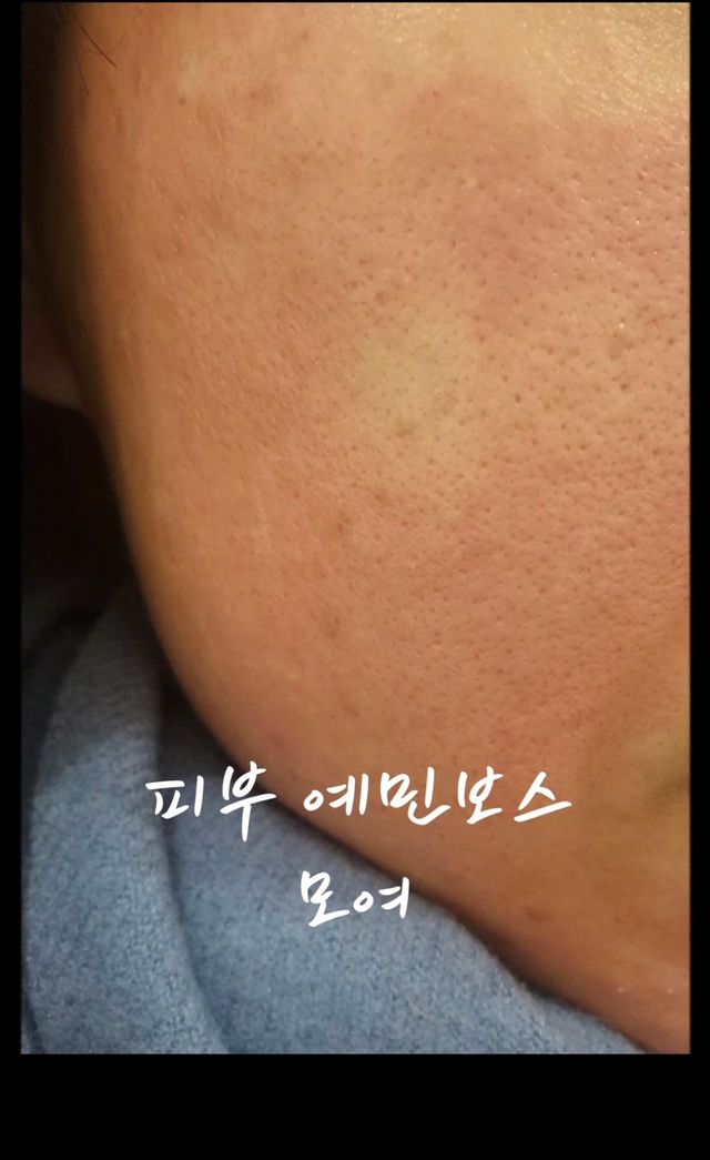 ★ ｜ Tiktok x 0.8L 에스트라리제덤 2차 크림 (최종) 리뷰 사진
