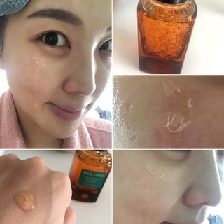 바이리뮤 에이지 홀딩 펩타톡스 앰플 — 4.5점을 준 리뷰어가 2021년 1월 올린 사용 사진