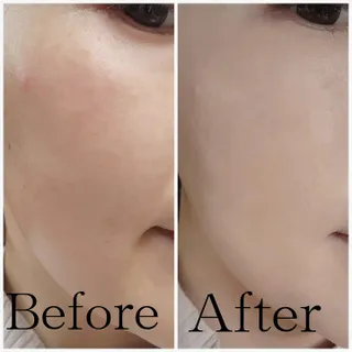 【AK BEAUTY 공식】 도자기 피부 만들기 올인원 베이스 세트 — 4점을 준 리뷰어가 2022년 10월 올린 사용 사진