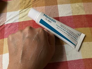 Melaxin 멜락신 TX 크림 50ml — 5점을 준 리뷰어가 2022년 9월 올린 사용 사진