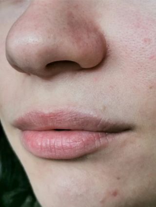 메이크나인 딥 하이드레이션 브라시카 앰플 45ML — 5점을 준 리뷰어가 2023년 1월 올린 사용 사진
