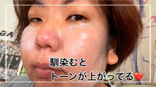 코드네이처 비아미 퍼펙트 케어 4종 — 4점을 준 리뷰어가 2021년 7월 올린 사용 사진