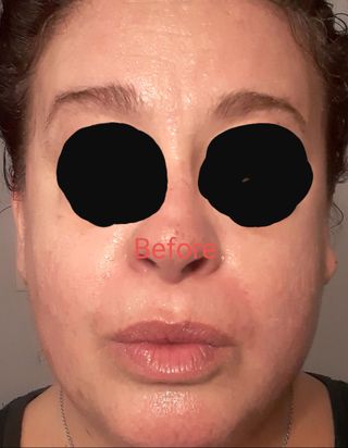 화이트 트러플 퍼스트 스프레이 세럼 — 5점을 준 리뷰어가 2021년 2월 올린 사용 사진