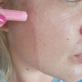 이지듀 리더마 마스터 앰플 1ml x 20 바이알 — 5점을 준 리뷰어가 2021년 8월 올린 사용 사진