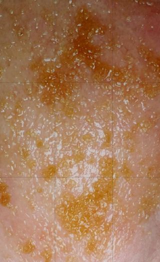 [THE SKIN HOUSE] Cacao Sugar Black Head Off — 5점을 준 리뷰어가 2022년 3월 올린 사용 사진