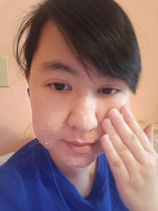 라비엘 모든 피부를 위한 RAVIEL 애플 마일드 필링 젤, 4.1 fl oz, 깊고 부드러운 각질 제거 — 3점을 준 리뷰어가 2022년 8월 올린 사용 사진