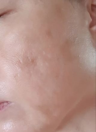 [THE SKIN HOUSE] Wrinkle System Essence — 5점을 준 리뷰어가 2022년 7월 올린 사용 사진