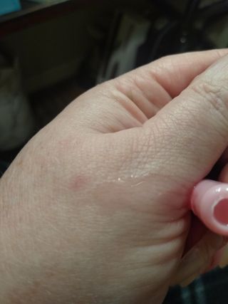 이지듀 리더마 마스터 앰플 1ml x 20 바이알 — 5점을 준 리뷰어가 2021년 2월 올린 사용 사진
