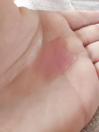 이지듀 리더마 마스터 앰플 1ml x 20 바이알 — 3점을 준 리뷰어가 2021년 2월 올린 사용 사진