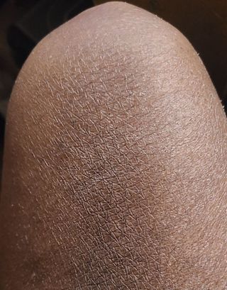 비엔디 2나우[ENG]BnD Body Whitening Underarm Cream — 5점을 준 리뷰어가 2024년 11월 올린 사용 사진