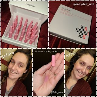 이지듀 리더마 마스터 앰플 1ml x 20 바이알 — 5점을 준 리뷰어가 2021년 2월 올린 사용 사진