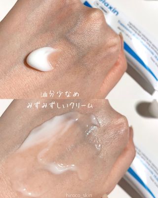 Melaxin 멜락신 TX 크림 50ml — 4.5점을 준 리뷰어가 2023년 5월 올린 사용 사진
