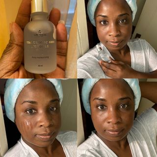 Vita Snail Cream + Hyaluronic 6000 ampoule — 5점을 준 리뷰어가 2021년 8월 올린 사용 사진