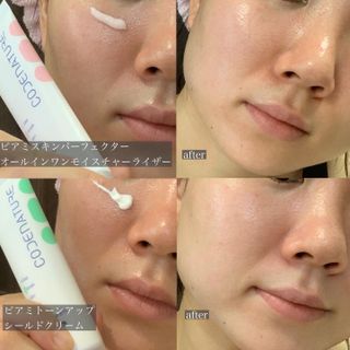 코드네이처 비아미 퍼펙트 케어 4종 — 5점을 준 리뷰어가 2021년 7월 올린 사용 사진