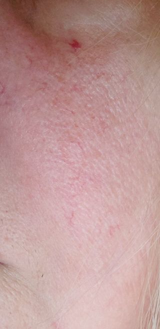 [THE SKIN HOUSE] Cacao Sugar Black Head Off — 5점을 준 리뷰어가 2022년 3월 올린 사용 사진