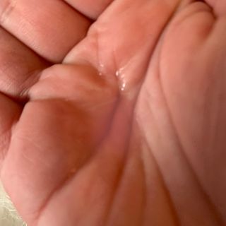 이지듀 리더마 마스터 앰플 1ml x 20 바이알 — 5점을 준 리뷰어가 2021년 4월 올린 사용 사진