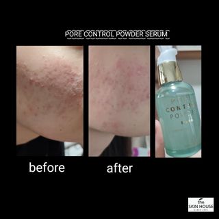 [THE SKIN HOUSE] Pore Control Powder Serum 50ml — 4점을 준 리뷰어가 2022년 7월 올린 사용 사진