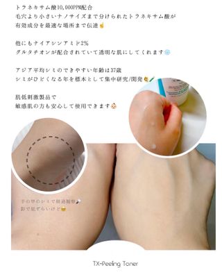 ank님이 올린 리뷰 사진 2