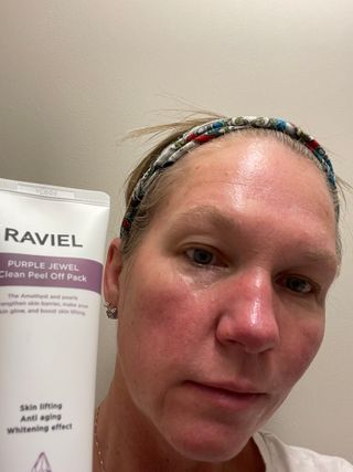 라비엘 RAVIEL 퍼플 쥬얼 클린 필 오프 팩, 마일드 블랙헤드 리무버, 4.1 fl oz(120ml) — 4점을 준 리뷰어가 2022년 9월 올린 사용 사진