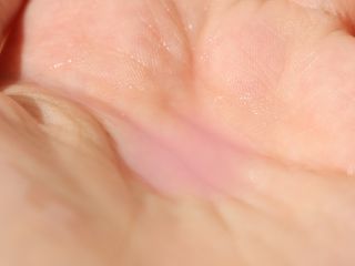 이지듀 리더마 마스터 앰플 1ml x 20 바이알 — 4점을 준 리뷰어가 2021년 8월 올린 사용 사진